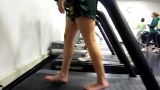 hip circumduction antalgic gait barefoot [upl. by Fagin493]