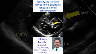 Identify the structure marked in this parasternal long axis view on echocardiogram [upl. by Weinstein]