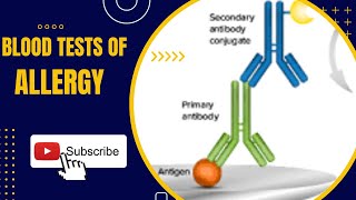 Blood Tests for Allergy RAST ELISA Pharmacognosy in Urdu Pharmacy Technicians part 1 [upl. by Halas]