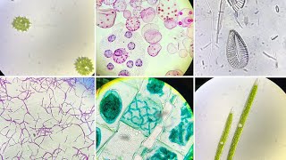 Microscopic Slides of Algae Live and Prepared [upl. by Hcra]