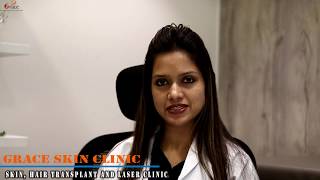 Microdermabrasion by dermatologist Dr Suman Agarwal [upl. by Neely]