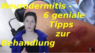 Neurodermitis Gesicht  6 Tipps zur Behandlung [upl. by Aitak]