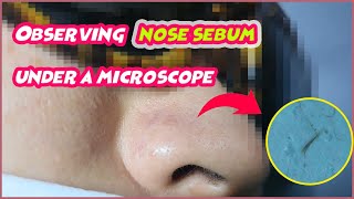 Observing nose sebum under a microscope [upl. by Ahkeber]