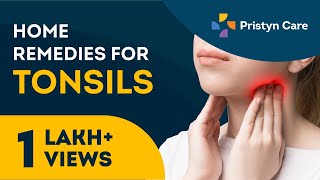 EFFECTIVE REMEDIES FOR SORE THROAT  TIPS  Philippines [upl. by Walliw]