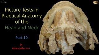 Picture tests in head and neck anatomy 10 [upl. by Ghassan]