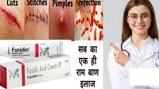 Fucidin Cream  Fucidic Acid Cream  ointment हिन्दी में Uses side effects  Honest review [upl. by Eizzil]