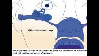 Oorontsteking  Oorzaak en behandeling oorpijn [upl. by Sieracki]