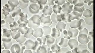 Blood in Hypertonic Solution produces crenated cells [upl. by Nnael]