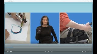 Hand Function after Spinal Cord Injury [upl. by Ariamoy]