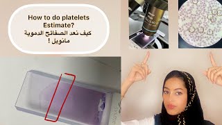 How to do platelets estimate from slide  طريقة عد الصفائح الدموية مانويل من السلايد 🩸 [upl. by Burty]