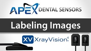 Apteryx XrayVision Labeling Images  Apex Dental Sensors  Training [upl. by Rae362]