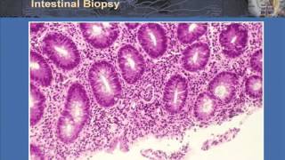 T Cell Effector Function Part 2  Th17 and T Regulatory Cells in Health and Disease [upl. by Werdma]