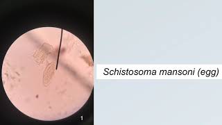 Trematodes Parasitology Practice Microscopic Identification [upl. by Ximenes]