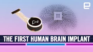 Elon Musk’s Neuralink brain implant New era of quotBrainComputer Interfacequot BCI technology [upl. by Anehsat]