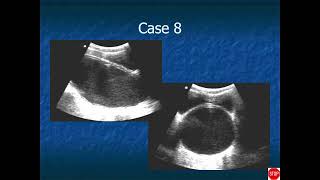 RADIOLOGY EXAM CASES [upl. by Etteuqal544]