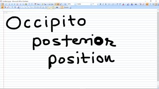 Occipito Posterior Position  types and Management [upl. by Belak]