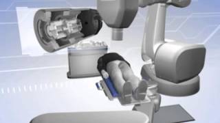 CyberKnife Robotic Radiosurgery  Variable Iris Overview [upl. by Korten]