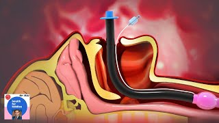 Difficult Airway Management  Airway Assessment  Intubation Anesthesiologist explains [upl. by On352]