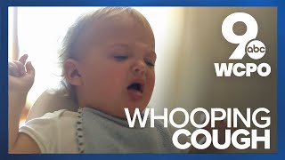 Sound of whooping cough [upl. by Newob150]