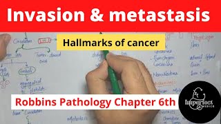 Invasion and Metastasis Hallmarks of CancerRobbins pathology chapter 6Neoplasiarobbinspathology [upl. by Balsam]