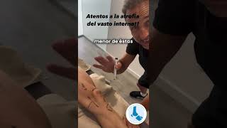 Lesiones de Rodilla Clave del Vasto Interno en la Recuperación y Prevención fyp viral parati [upl. by Zetnahs94]