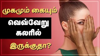 Uneven Skin Tone  Skincare for CLEAR amp GLOWING  Tamil Beauty Tips [upl. by Nej]