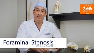 Foraminal Stenosis  360 Ortho amp Spine [upl. by Teryl]