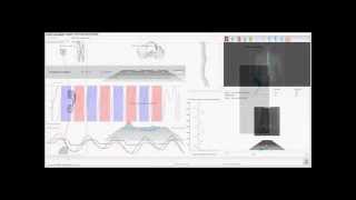 DIERS 4D motion® Lab  Analysis of Spine Leg axis Foot pressure in one compact system [upl. by Ajad532]