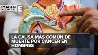 Cáncer de próstata un mal silencioso que ataca a varones [upl. by Johnnie]