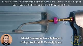 Tutorial Jarum Endodontik ProTaper Gold feat SX Dentsply Sirona [upl. by Htebzil]