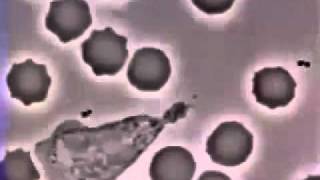 globule blanc attaque une bacterie m1 [upl. by Llerehs]