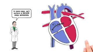 Transposition of the Great Arteries Vessels  Congenital Heart Defects Nursing NCLEX Pediatrics [upl. by Sathrum668]