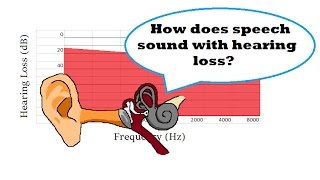 How Does Speech Sound with Hearing Loss [upl. by Ramedlaw]