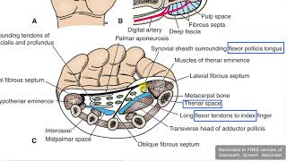 Palm fascial spaces 3 [upl. by Alyak]