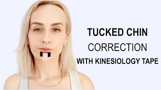 KINESIO TAPE FOR CHIN REJUVENATION [upl. by Burck]