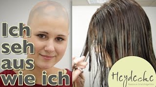 Kreisrunder Haarausfall bei Frauen Ich sehe aus wie ich dank Heydecke natureLine Echthaar Perücke [upl. by Leventis]