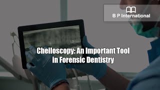 Cheiloscopy An Important Tool in Forensic Dentistry [upl. by Etnwahs]