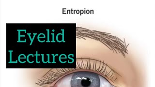 Eyelid lectures part 2 Eye lectures ophthalmology jatoi eyelectures eyelid eyedetaillecture [upl. by Sivla]