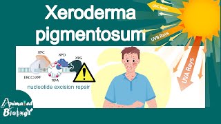 Xeroderma pigmentosum  What is the main cause of xeroderma pigmentosum  treatment of XP  USMLE [upl. by Gierk]