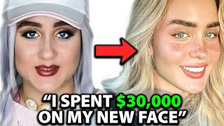 I was UGLY Before Spending 30000 on a NEW FACE  Surgeon Reacts [upl. by Lynnelle]