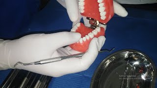 Limpieza de SarroPlaca Dental FACIL [upl. by Naugal]