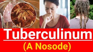 Tuberculinum homeopathic medicine  Learn which of lung is involved in different medicines [upl. by Asil]