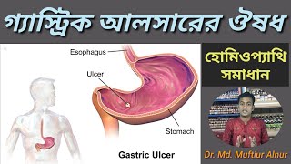 Gastric Ulcer Homeopathy Treatment In Bangla  গ্যাস্ট্রিক আলসার থেকে মুক্তির উপায়  Stomach ulcer [upl. by Rucker]