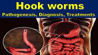 Intestinal Nematodes Ancylostoma and Necator microbiology nematode [upl. by Ibloc693]