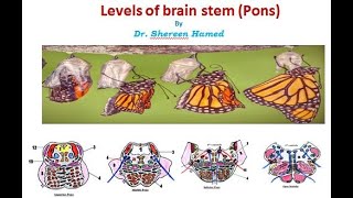 practical brain stem levels pons [upl. by Blinny]