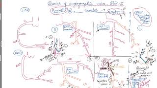 Basics of angiographic views PartII [upl. by Nil841]