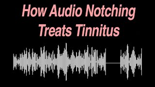 How Audio Notching Treats Tinnitus [upl. by Arul]