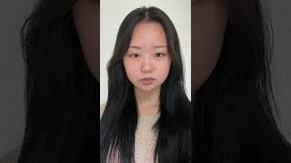 Korean girl before and after double eyelid surgery [upl. by Ennovehc]