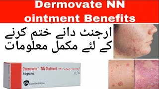 Dermovate NN ointmentHow to use dermovate for skin fungal infections remove acne pimple scar [upl. by Harrison]