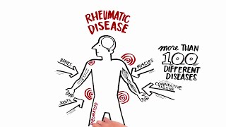 Rheumatic heart disease prophylaxis [upl. by Rorrys]